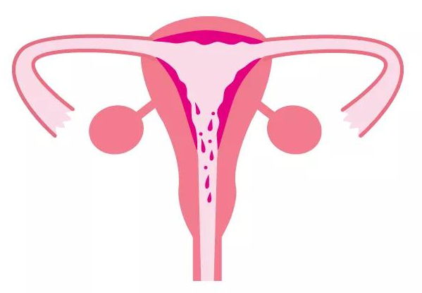 解析子宫内膜怎样保养才科学？